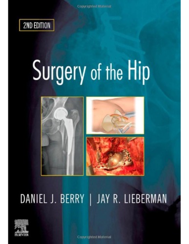 Surgery of the Hip, 2ED