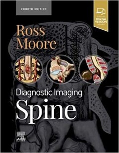 Diagnostic Imaging: Spine, 4ED
