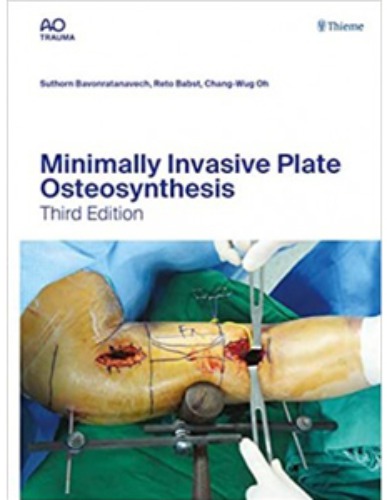 Minimally Invasive Plate Osteosynthesis, 3ED