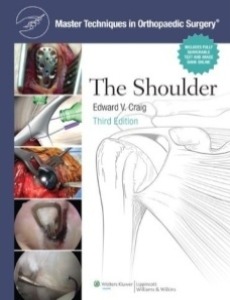 Master Techniques in Orthopaedic Surgery: Shoulder 3ED