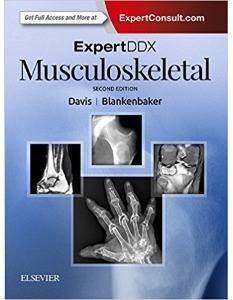 ExpertDDx: Musculoskeletal, 2ED