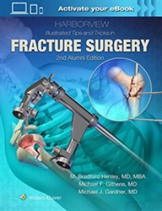 Harborview Illustrated Tips and Tricks in Fracture Surgery, 2ED