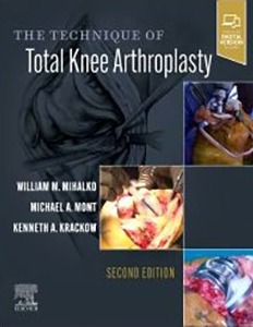 The Technique of Total Knee Arthroplasty 2ED