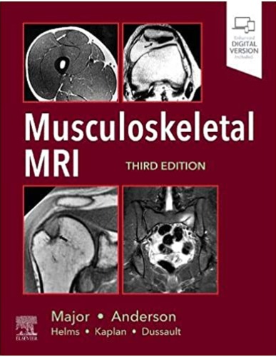 Musculoskeletal MRI, 3ED