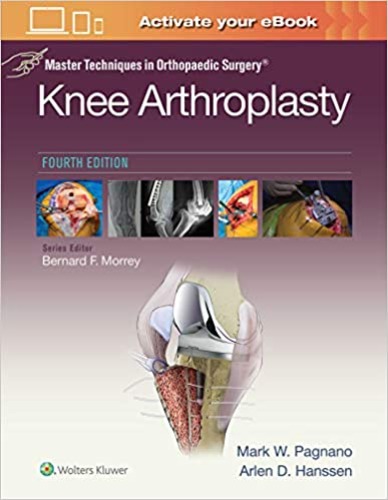 Master Techniques in Orthopaedic Surgery: Knee Arthroplasty, 4ED