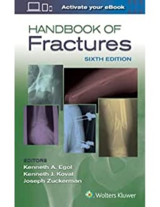 Handbook of Fractures, 6ED
