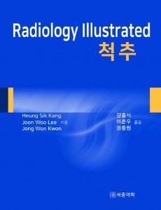 Radiology Illustrated : 척추